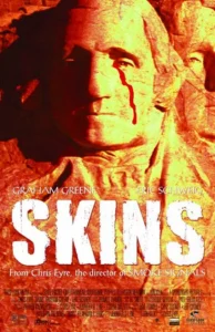 skins
